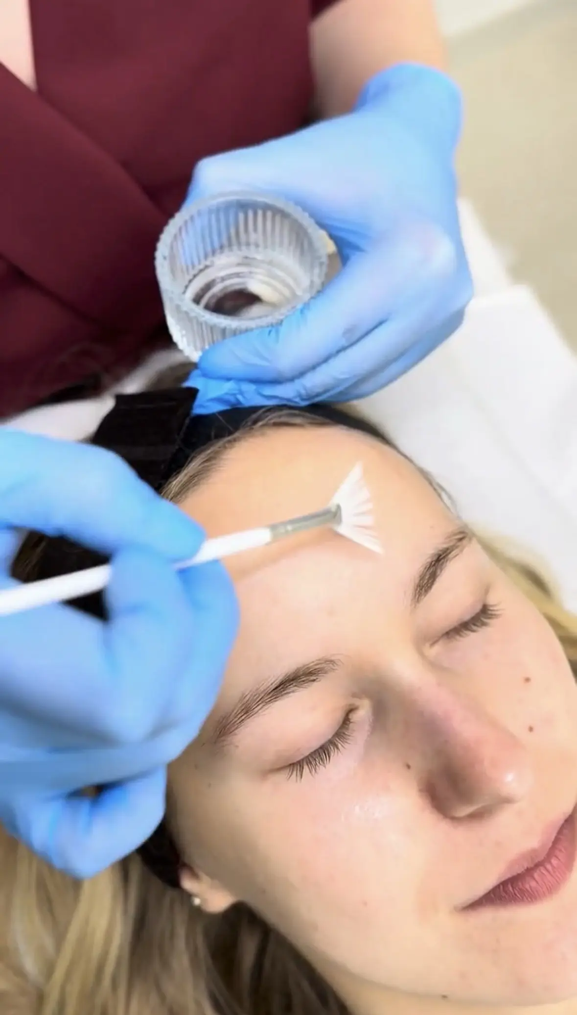 Nakładanie peelingu chemicznego pędzelkiem na czoło klientki